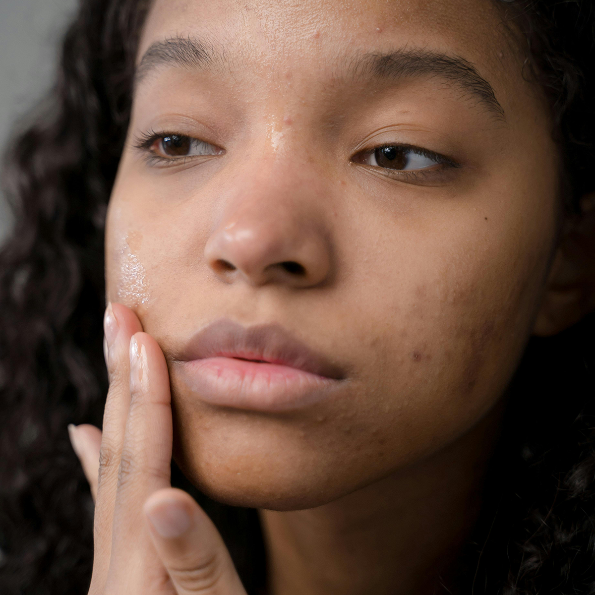 The Skin-Deep Effects of Stress: National Stress Awareness Day